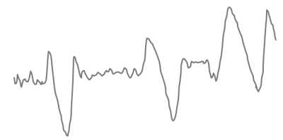 Muscle measurement –  Electromyography (EMG)