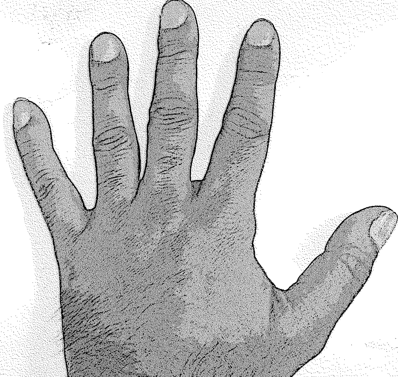 Neural network analysis of human hand for cholesterol